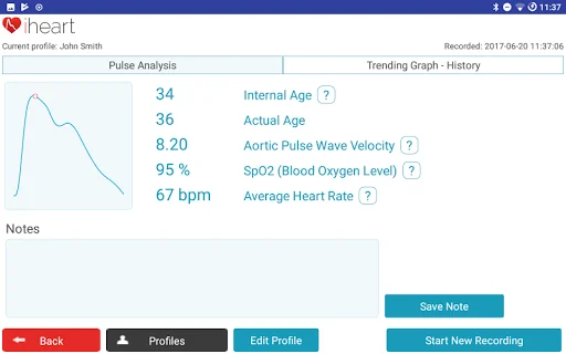 iHeart Internal Age ডাউনলোড করুন – আপনার আয়ু পরিমাপ করুন - Screenshot 14