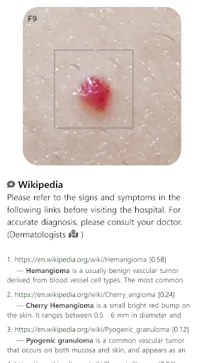 Model Dermatol ডাউনলোড করুন – চর্মরোগ শনাক্তকরণের সেরা অ্যাপ - Screenshot 11