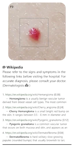 Model Dermatol ডাউনলোড করুন – চর্মরোগ শনাক্তকরণের সেরা অ্যাপ - Screenshot 5