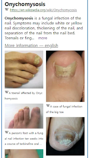 Model Dermatol ডাউনলোড করুন – চর্মরোগ শনাক্তকরণের সেরা অ্যাপ - Screenshot 2