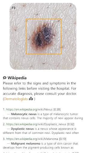 Model Dermatol ডাউনলোড করুন – চর্মরোগ শনাক্তকরণের সেরা অ্যাপ - Screenshot 9